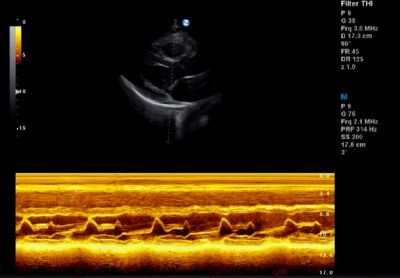 Cardiac M Mode